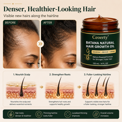 Ceoerty® Batana Natural Hair Growth Oil