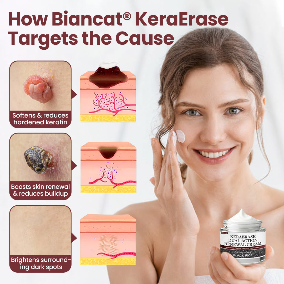 Biancat®KeraErase Dual-Action Renewal Cream❣️