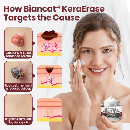 Biancat®KeraErase Dual-Action Renewal Cream❣️