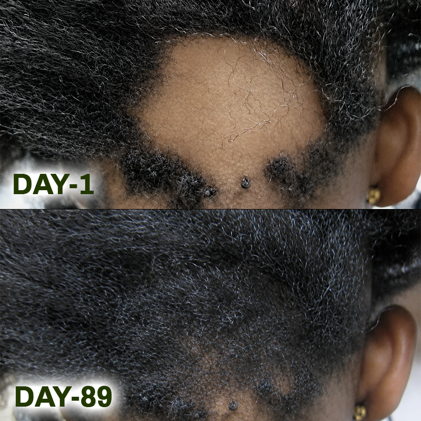 Ceoerty® Batana Natural Hair Growth Oil