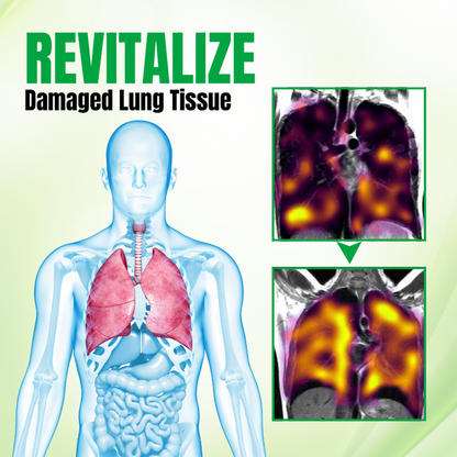 🚭 Biancat® RespiPure Herbal Lung Detox Spray 🌿 Herbal Breathing Spray for Smoke, Dust & Dry Air Exposure | Botanical Respiratory Support | Daily Fresh Air Routine💝